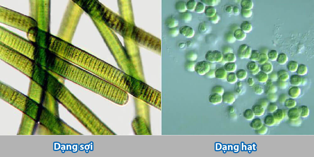 Hình dạng tảo lam khi quan sát dưới kính hiển vi